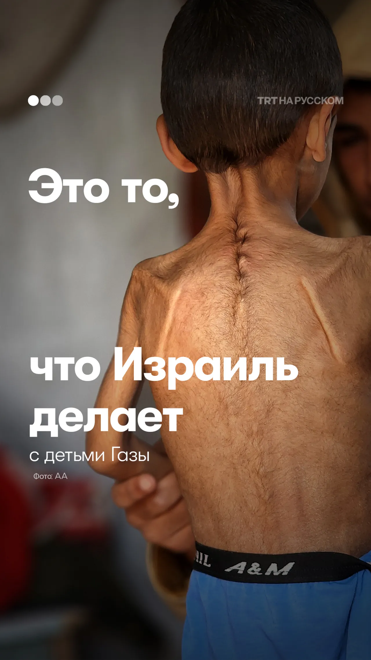 Израильская блокада превращает голод в оружие: десятки тысяч детей на грани